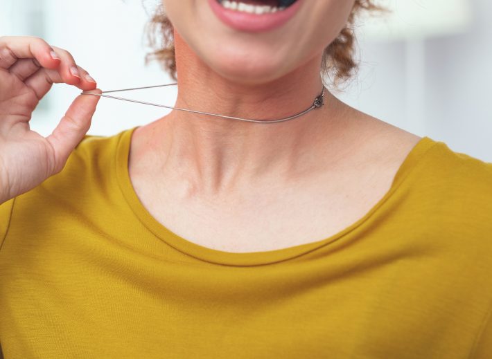 アクセサリーのトラブル