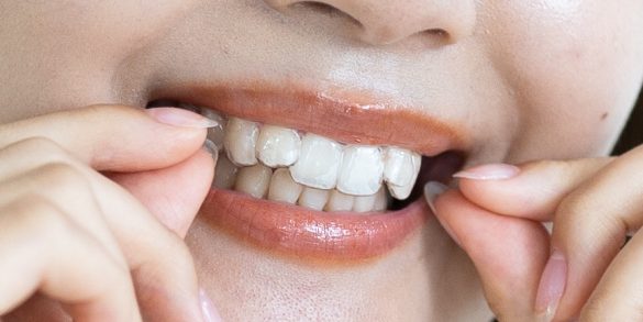 各務先生提供写真