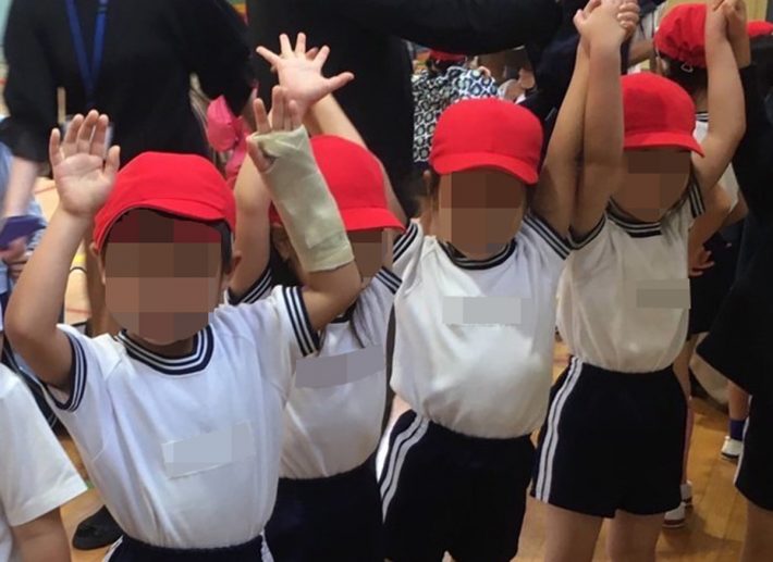 子どもを襲う老化