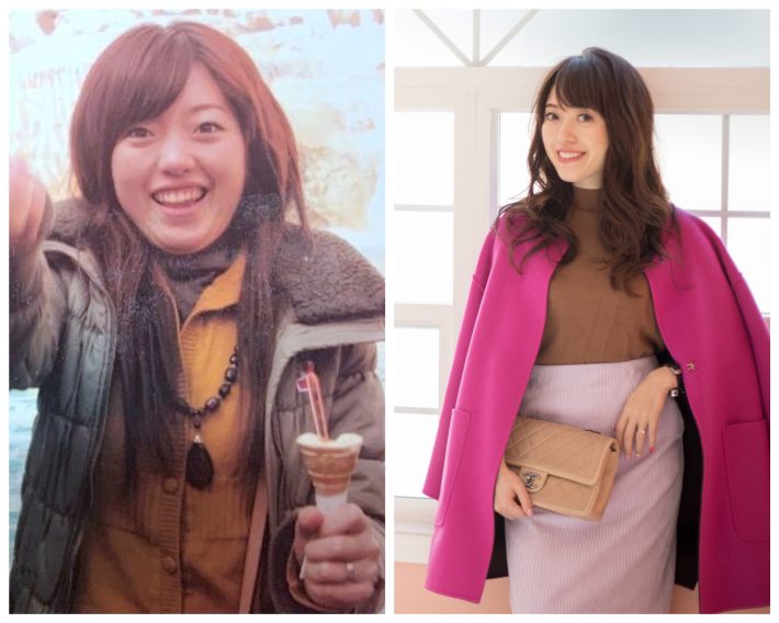 松田リエさんのビフォーアフター