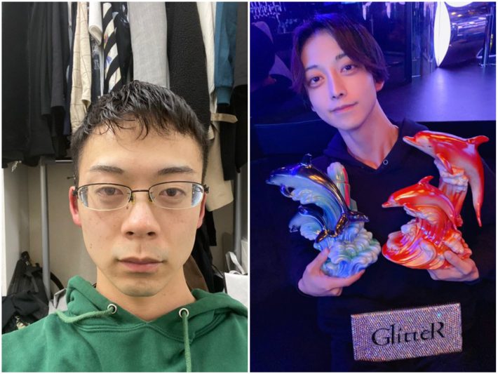 ゆうり　骨延長