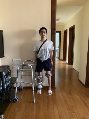 ゆうり　骨延長