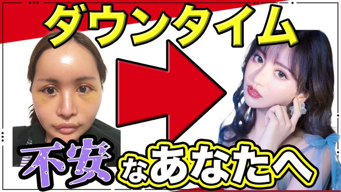 美容整形ちゃん