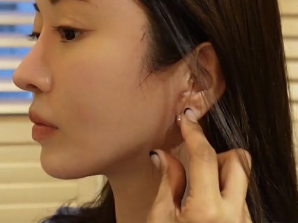 美容整形ちゃん