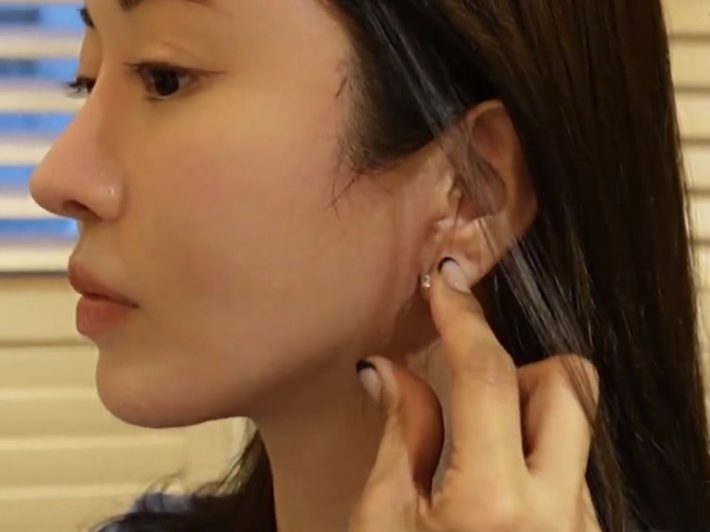 美容整形ちゃん