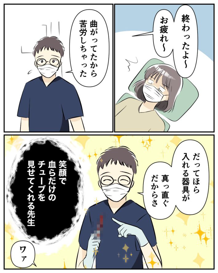 ミレーナ　装着レポ