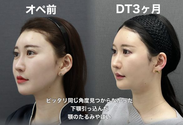 みるくナースさん