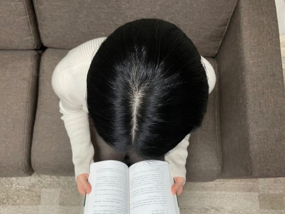 頭皮の色