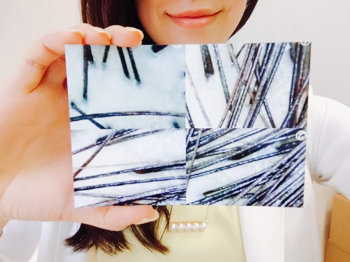 頭皮の状態を見る時は何か所かをチェック