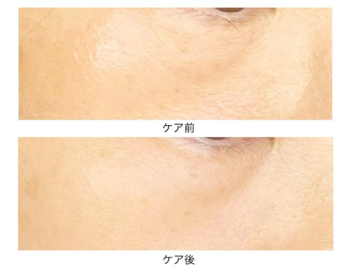 ケア前・ケア後