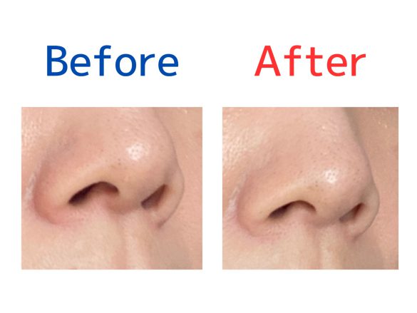 キャンメイクパウダーコンシーラ