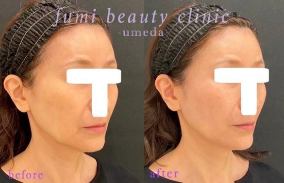 篠原　秀勝先生