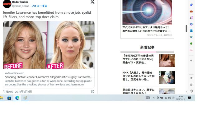 ジェニファーの顔の変化を示すビフォーアフターの写真