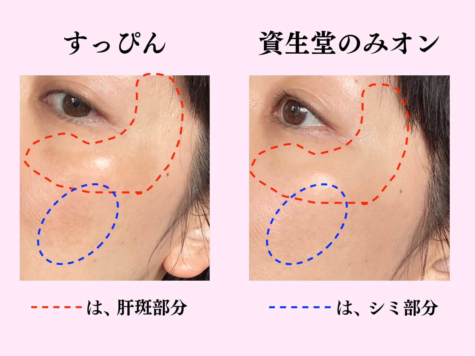 資生堂 すぽつつかばーファンデーション 色 シミ