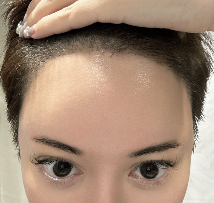 美容整形ちゃん