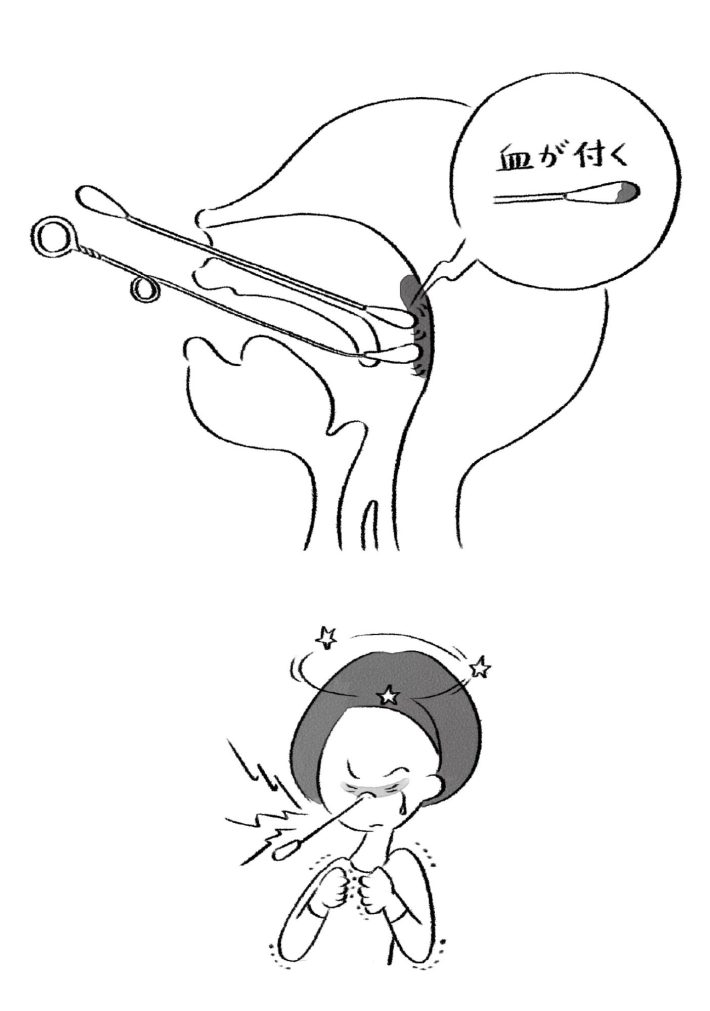 『その不調の原因は慢性上咽頭炎にあった』