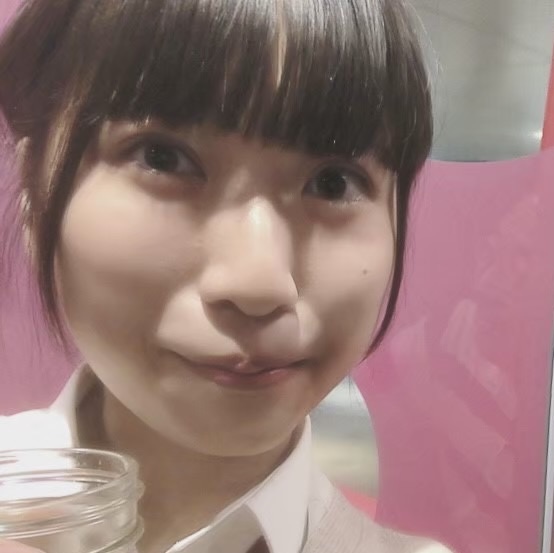 みこぴさま_二重整形後