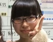 みこぴさま_整形前