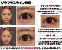 みこぴさま_カウンセリング資料