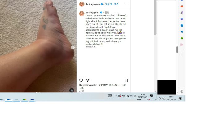 パンパンに腫れた足の映像を投稿したブリトニー