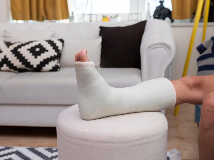 骨折した足の写真