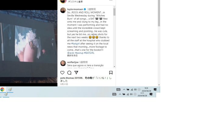 テイラーの太ももをかむコウモリ