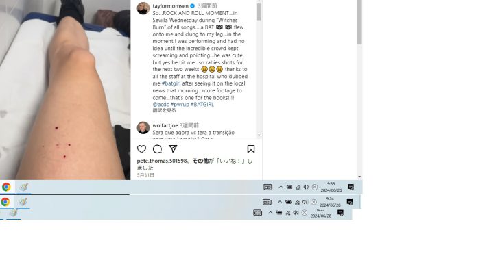 コウモリにかまれた痕がのこるテイラーの足