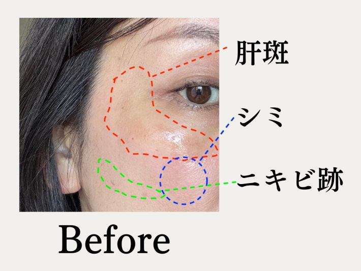 シミコンシーラー