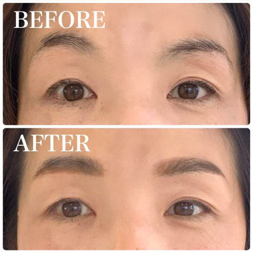 別の人の例。眉はシンメトリーに補正しましょう