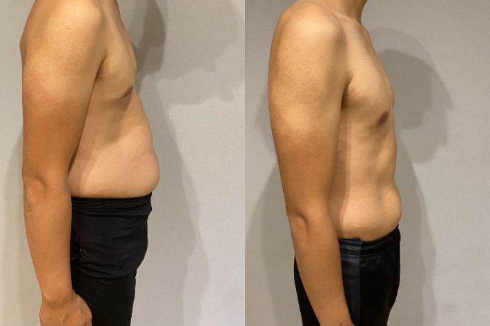 ダイエット前と今のしょーさん（夫）