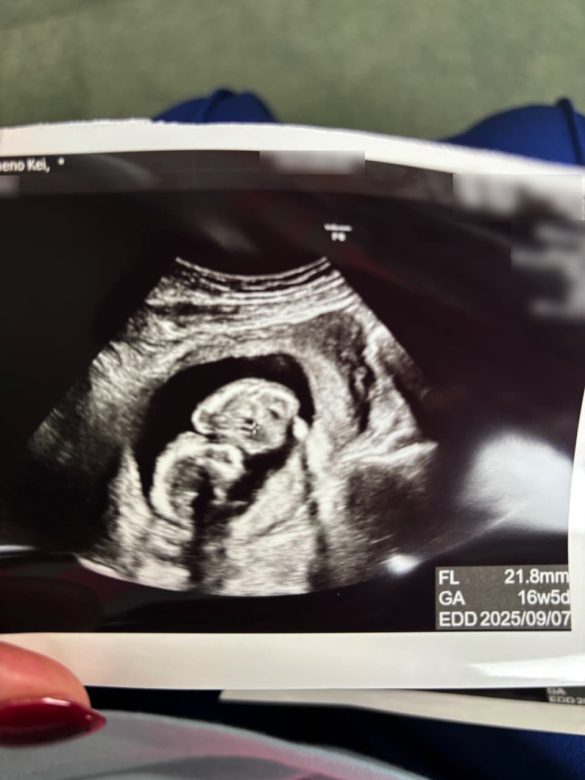 妊娠が判明したときにもらったエコー写真