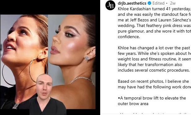 クロエの現在と過去の写真を比較・分析するジョニー・ベタリッジ氏