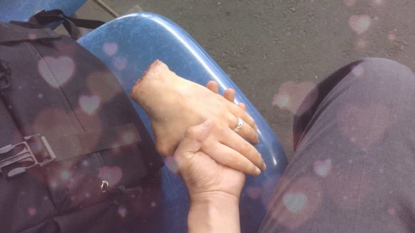 「彼女と下校なう」とラブラブだが、手首から先がない