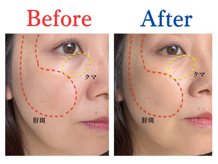 Before After エクセル エシリアル セラムコンシーラー
